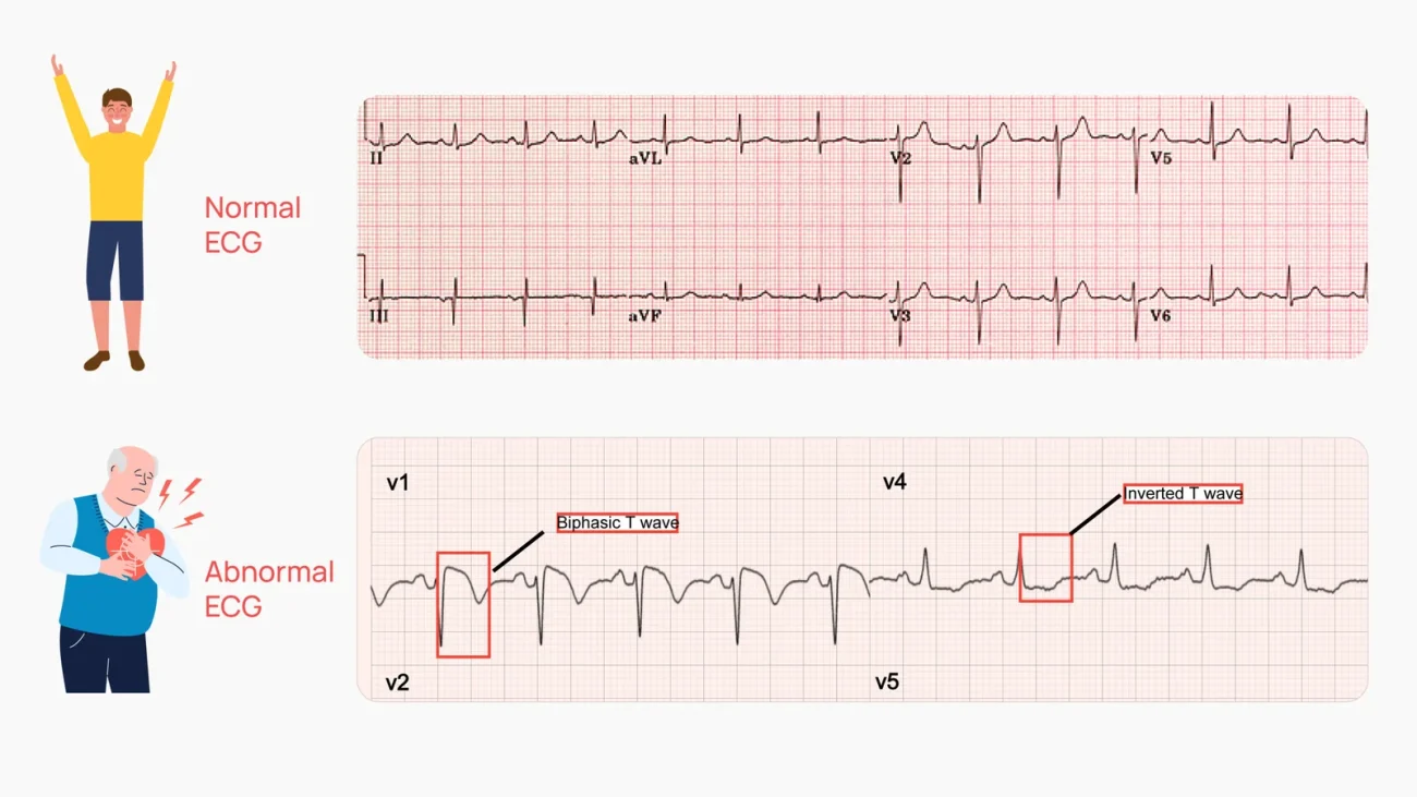 نوار قلب (ECG) با دکتر ایمان پورغلامی؛ چطور در ۵ دقیقه سلامت ریتم قلبتان را چک کنید 2 blog images 01 1 scaled 1