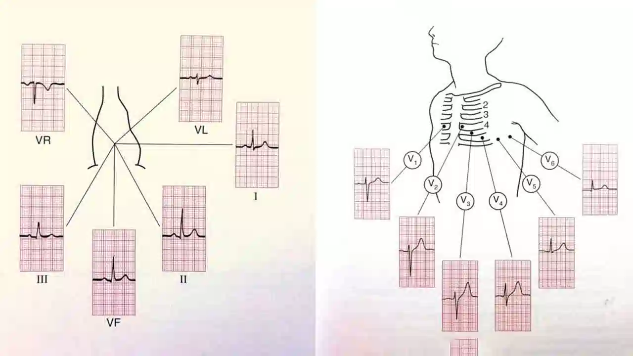 نوار قلب (ECG) با دکتر ایمان پورغلامی؛ چطور در ۵ دقیقه سلامت ریتم قلبتان را چک کنید 1 cdn cdn Electrical activity in the Ekg 1664009380