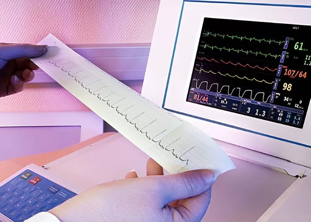 نوار قلب (ECG) با دکتر ایمان پورغلامی؛ چطور در ۵ دقیقه سلامت ریتم قلبتان را چک کنید 
